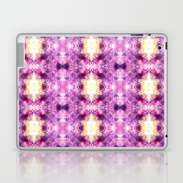 Purple Tye-Dye Kaleidoscope Laptop Skin