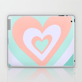 Love Power - Retro Teal and Coral Laptop Skin