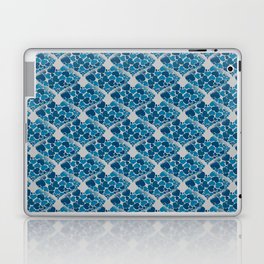 When Hearts Meet Together Pattern - Blue Grey Hearts (On Grey) Laptop Skin