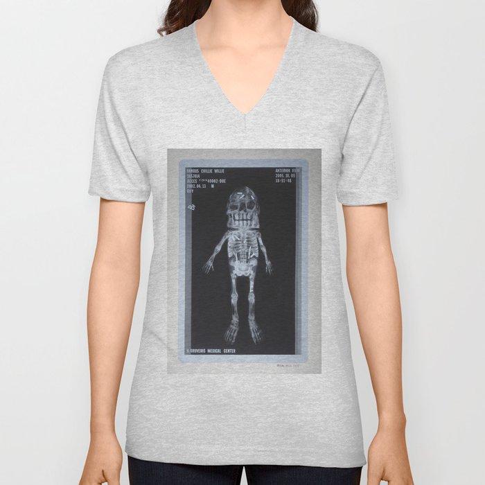 X-Ray of Famous Chillie Willie V Neck T Shirt