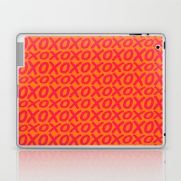 Orange pink Hugs and kisses Valentine gift Laptop Skin