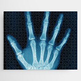 Hand X-Ray Jigsaw Puzzle