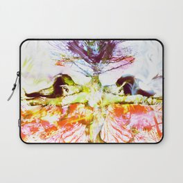 Divided Laptop Sleeve | Digital, Dream, Twins, Birth, Roots, Forest, Body, Photo, Strong, Woman 