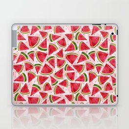 Watermelon Wonder Laptop Skin