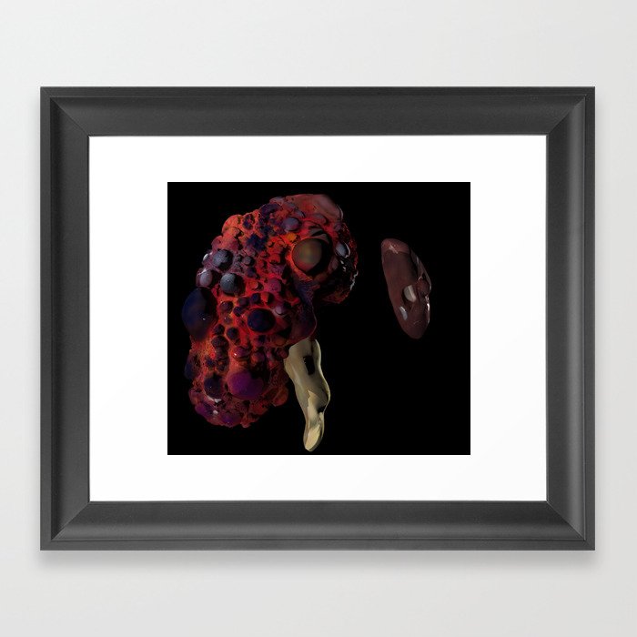 Polycystic Kidney Disease Framed Art Print