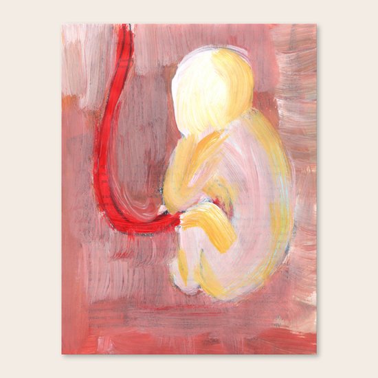 expecting Canvas Print