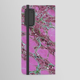 Decorative Paper 15 Android Wallet Case