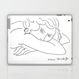 Young Woman With Face Buried In Arms (jeune Femme Le Visage Enfoui Dans Les Bras), Henri Matisse, Ar Laptop Skin