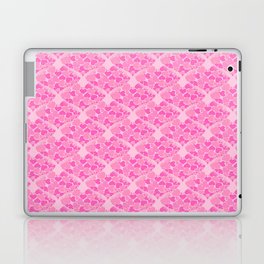 When Hearts Meet Together Pattern - Girly Pink Hearts (On Pink) Laptop Skin