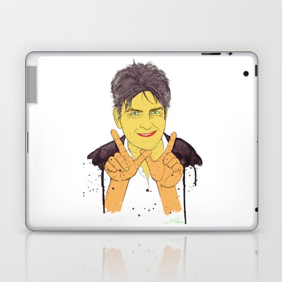 W is for Winning Laptop & iPad Skin
