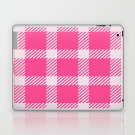 Pink & White Color Check Design Laptop Skin