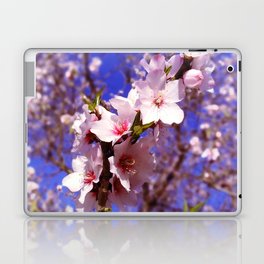 Almond flower, almond blossom - almond tree with blue sky Art Print Laptop Skin