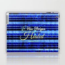BY HIS STRIPES Colorful Blue Stripes Bible Scripture Fine Art Pattern Typography God Jesus Faith Laptop & iPad Skin