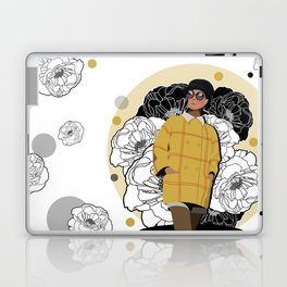 YELLOW- Colour of Happiness Laptop & iPad Skin