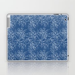 Twiggy Blue Laptop Skin