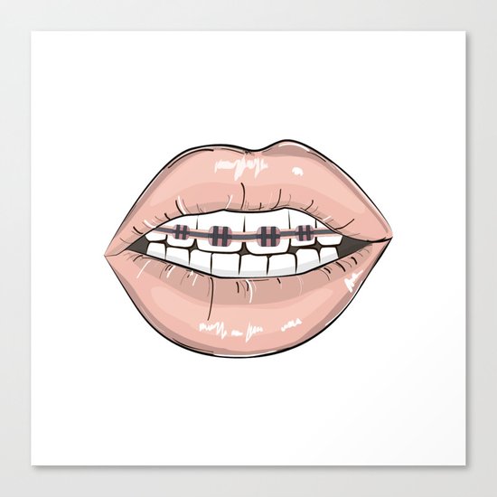Lips vs braces Canvas Print