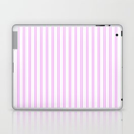 Lilac Pink and White Narrow Vintage Provincial French Chateau Ticking Stripe Laptop Skin