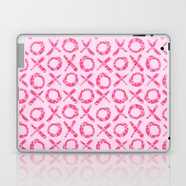 HUGS AND KISSES XOXO FLORAL LOVE PATTERN Laptop Skin