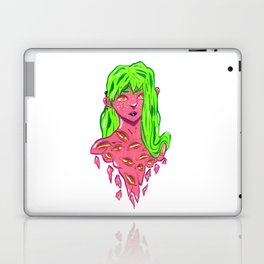 Watermelon Laptop Skin