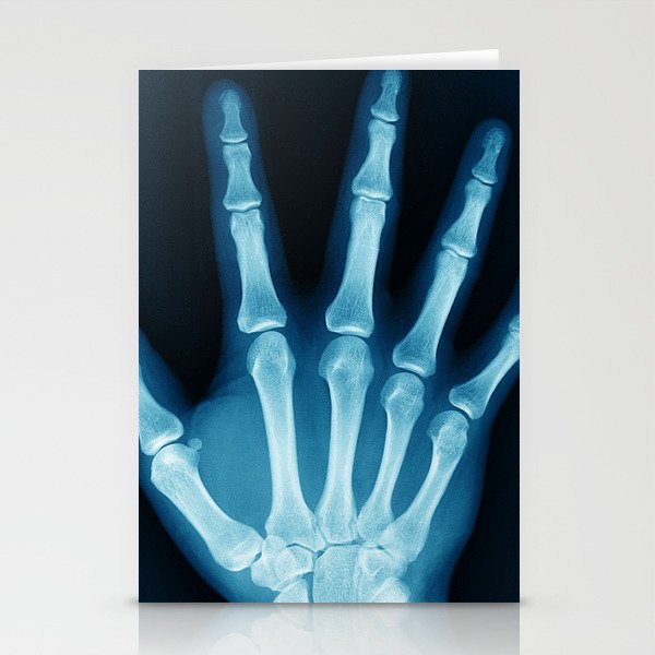 Hand X-Ray Stationery Cards