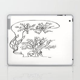 Tree House Laptop Skin