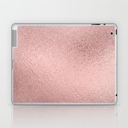 Metallic Pink Laptop Skin