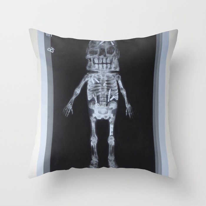 X-Ray of Famous Chillie Willie Throw Pillow