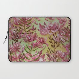 This is For You Laptop Sleeve
