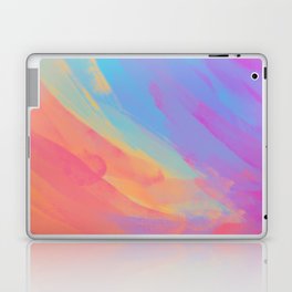 full color summer Laptop Skin