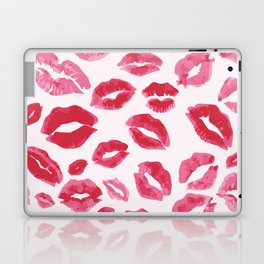 Lipstick Kisses Laptop & iPad Skin