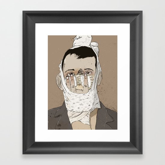 Rhinoplasty Framed Art Print