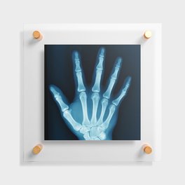 Hand X-Ray Floating Acrylic Print
