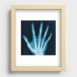 Hand X-Ray Recessed Framed Print