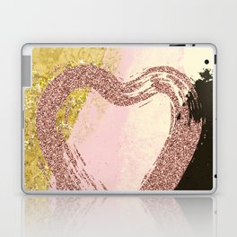 A Hearts Desire Laptop Skin