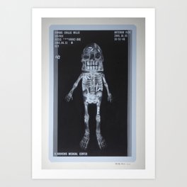 X-Ray of Famous Chillie Willie Art Print