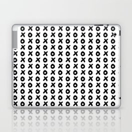 XOXO pattern black and white Laptop Skin