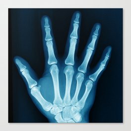 Hand X-Ray Canvas Print