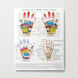 Acupressure Reflexology Chart With Precise Hand Diagrams. Metal Print