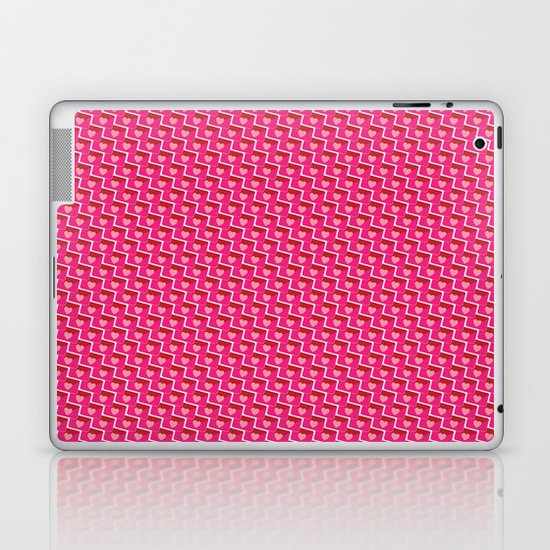 Chain Mail Laptop & iPad Skin