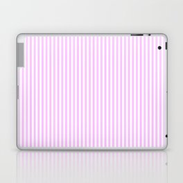 Lilac Pink and White Micro Vintage English Country Cottage Ticking Stripe Laptop Skin