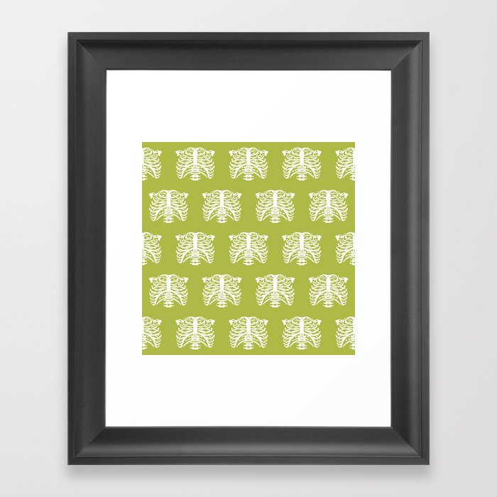 Human Rib Cage Pattern Chartreuse Green Framed Art Print