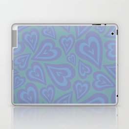 Retro Swirl Love - Blue and teal Laptop Skin