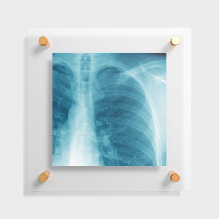 X-Ray Floating Acrylic Print