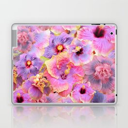 Tropical hibiscus patterns Flower Floral Flowers Laptop Skin
