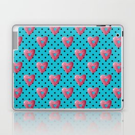 Pink plaid watercolor heart shaped donuts with polka dots on blue background Laptop Skin