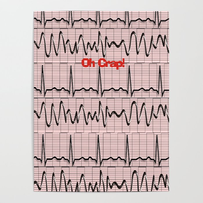 Vie en sælger Inspicere Cardiac Rhythm Strips EKG Poster by Kippygirl | Society6