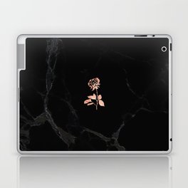 Forever Petal (Black Rose) Laptop Skin