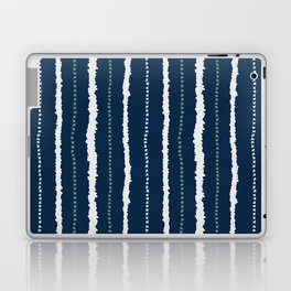 Navy Blue and Sage Stripes Laptop Skin
