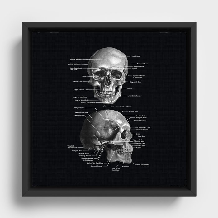 Framed Canvas