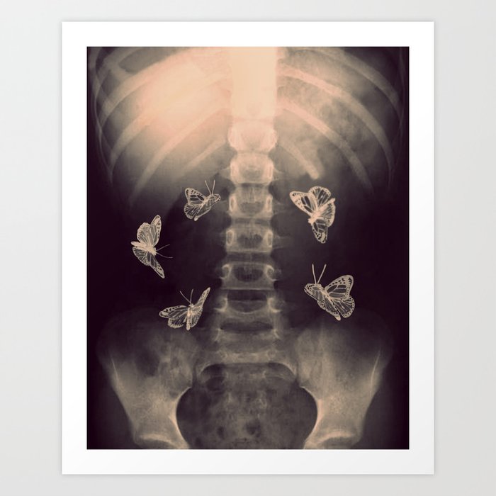 Stomach Butterflies Art Print by AndreaClare | Society6